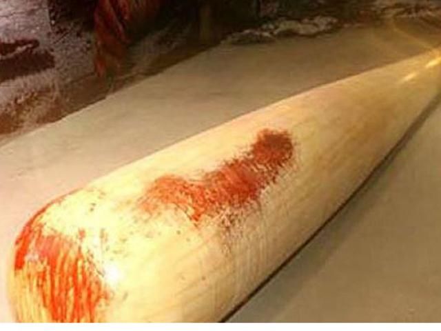 Чиновника, который отвечает за лес и охотничьи угодья на Закарпатье, жестоко избили Чиновника, который отвечает за лес и охотничьи угодья на Закарпатье, жестоко избили