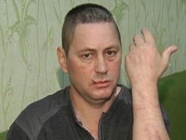 СМИ: Во время обыска в квартире Мазурка избили инвалида (Фото) СМИ: Во время обыска в квартире Мазурка избили инвалида (Фото)