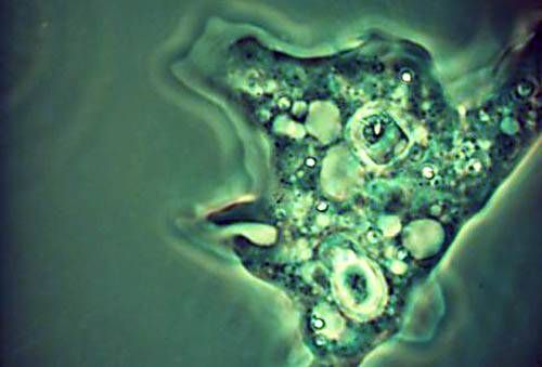 У Пакистані небезпечна амеба вбила уже 10 людей У Пакистані небезпечна амеба вбила уже 10 людей