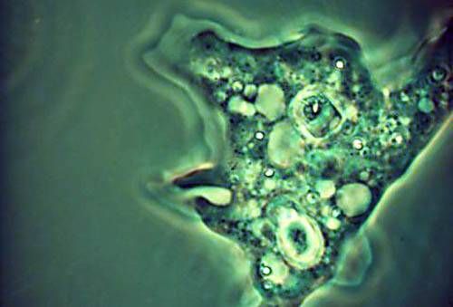 В Пакистане опасная амеба убила уже 10 человек