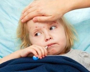 Харьковчане впервые за пять лет заболели корью Харьковчане впервые за пять лет заболели корью