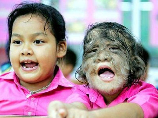 Найбільш волохата дівчинка потрапила в книгу Гіннеса (Фото) Найбільш волохата дівчинка потрапила в книгу Гіннеса (Фото)