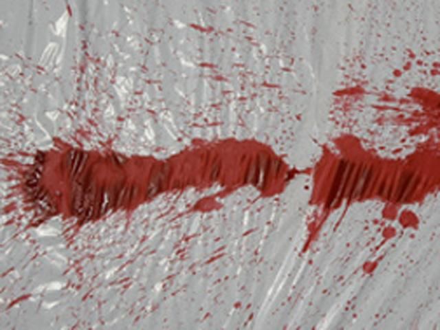 На Днепропетровщине пара пробила женщине голову прямо на автобусной остановке На Днепропетровщине пара пробила женщине голову прямо на автобусной остановке