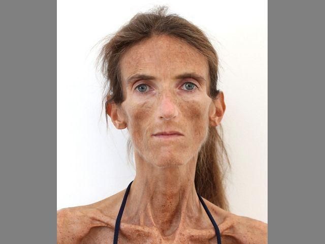 У Монако живе "жива мумія" (Фото) У Монако живе "жива мумія" (Фото)