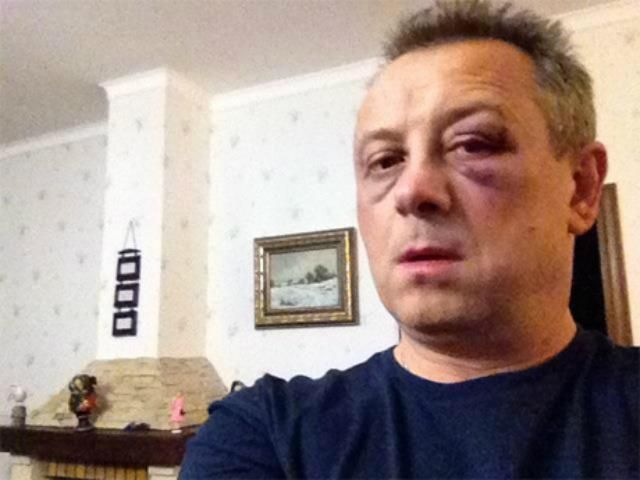 Прокуратура взялась за справу щодо побиття нардепа