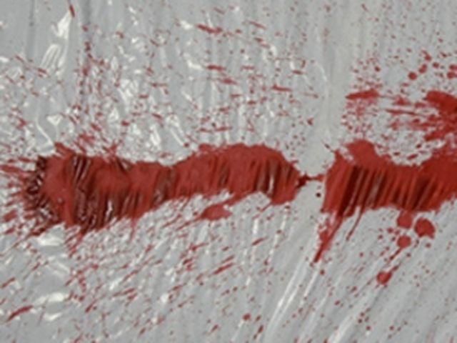 Во Львове возле монастыря жестоко избили двух женщин Во Львове возле монастыря жестоко избили двух женщин