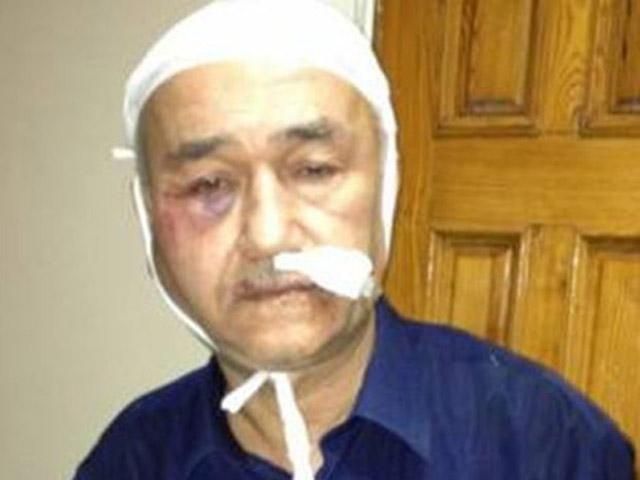 У Криму невідомі напали на одного з впливових членів Меджлісу У Криму невідомі напали на одного з впливових членів Меджлісу