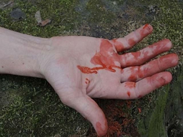 На Харківщині пенсіонер кочергою убив свою дружину На Харківщині пенсіонер кочергою убив свою дружину