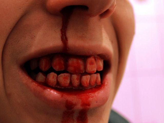 На Николаевщине пьяный хулиган покусал милиционера На Николаевщине пьяный хулиган покусал милиционера