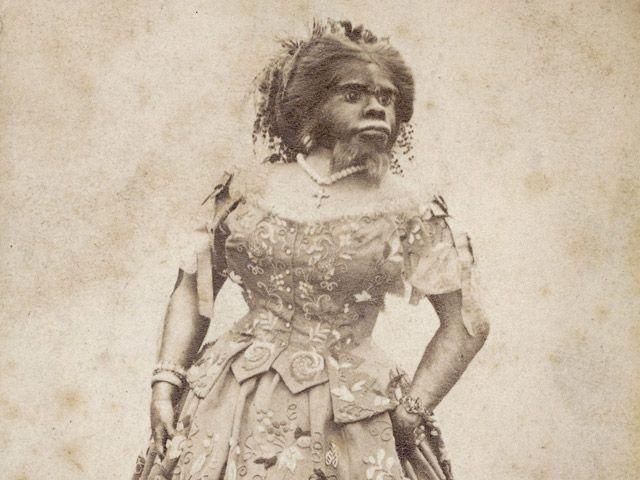 В Мексике похоронили "женщину-обезьяну" (Фото) В Мексике похоронили "женщину-обезьяну" (Фото)