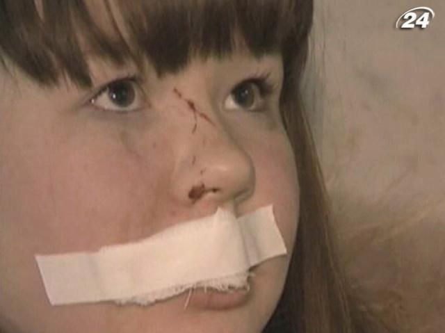 В результате падения метеорита около тысячи человек получили ранения В результате падения метеорита около тысячи человек получили ранения