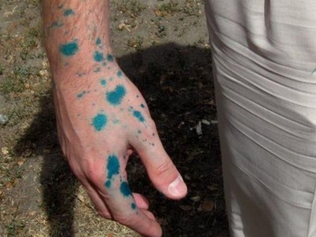 На Власенко вновь совершили "покушение" с зеленкой На Власенко вновь совершили "покушение" с зеленкой