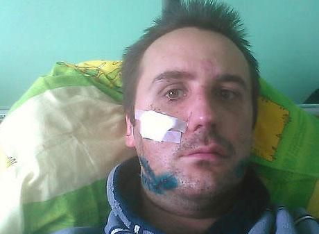 На Запоріжжі напали на журналіста: 6 поранень від заточки