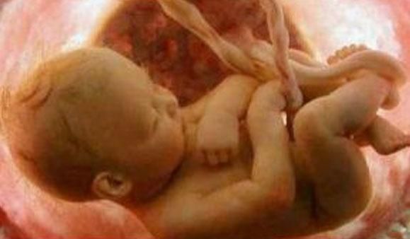 Закон о запрете абортов окончательно отвергнут Закон о запрете абортов окончательно отвергнут