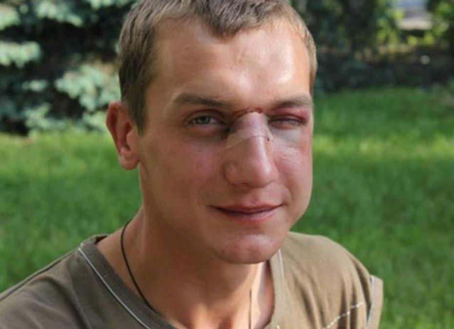"Что, офигенный националист?", - активиста избили за украинский язык (Видео) "Что, офигенный националист?", - активиста избили за украинский язык (Видео)