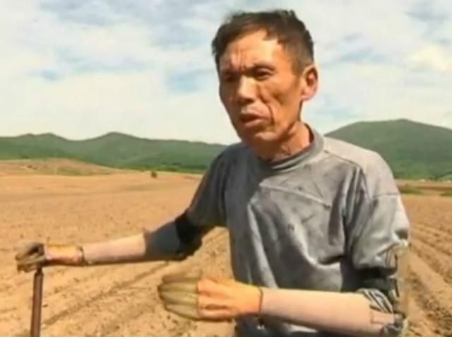 Китаєць самостійно змайстрував собі протези двох рук (Відео)