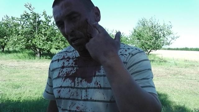 "Братки" із зброєю захопили підприємство опозиційного кандидата: є важко поранені (Фото) "Братки" із зброєю захопили підприємство опозиційного кандидата: є важко поранені (Фото)