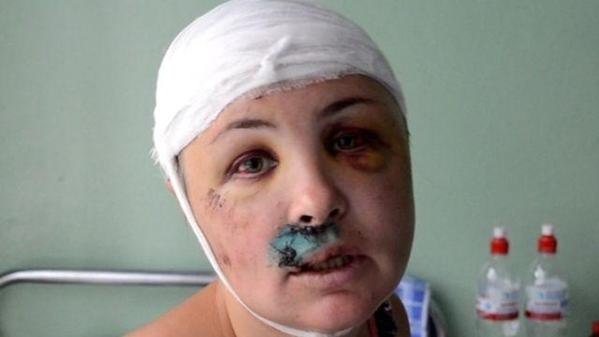 Изнасилованную в Врадиевке девушку охраняют, потому что родственники боятся за ее жизнь Изнасилованную в Врадиевке девушку охраняют, потому что родственники боятся за ее жизнь