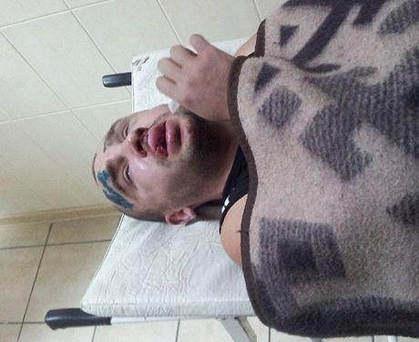В Донецке жестоко избили активиста "Дорожного контроля" (Фото)