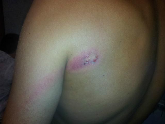 В Мариуполе напали на еще одного активиста "Дорожного контроля" В Мариуполе напали на еще одного активиста "Дорожного контроля"