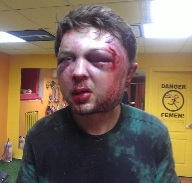 Политолога FEMEN избили до полусмерти (Фото) Политолога FEMEN избили до полусмерти (Фото)