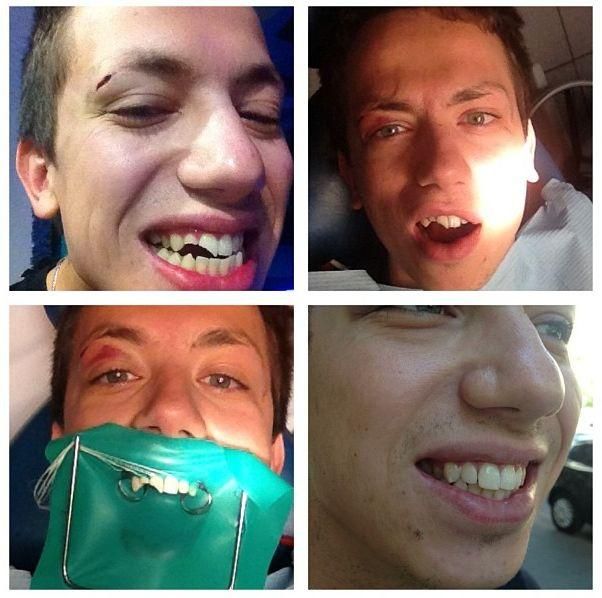 В Днепродзержинске выбили зубы скандальному ведущему Дурневу (Фото)