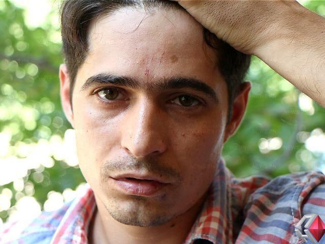 В Николаеве парень рассказал, как его посреди улицы избили милиционеры В Николаеве парень рассказал, как его посреди улицы избили милиционеры