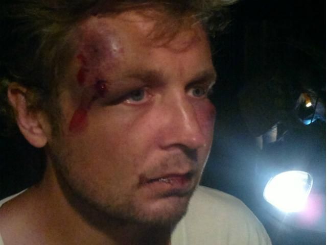 По факту нападения на активистов FEMEN открыли уголовное производство По факту нападения на активистов FEMEN открыли уголовное производство