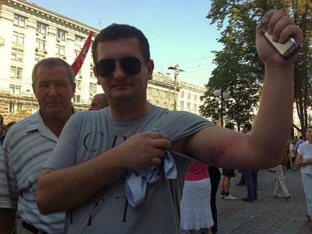 УДАРовца избили в Киевсовете: разорвали рубашку, на руках - гематомы и синяки