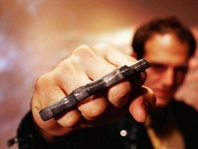 На Закарпатті побили бізнесмена: чоловік — у реанімації На Закарпатті побили бізнесмена: чоловік — у реанімації