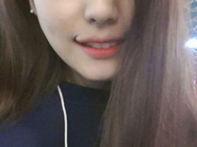 Новый хирургический тренд для женщин - "улыбка Джокера" (Фото) Новый хирургический тренд для женщин - "улыбка Джокера" (Фото)