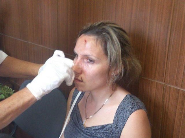 Жительница Керчи показала, как ее избил начальник водоканала (Фото. Видео)
