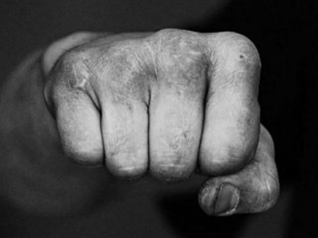 В Харькове напали на помощника нардепа от оппозиции В Харькове напали на помощника нардепа от оппозиции