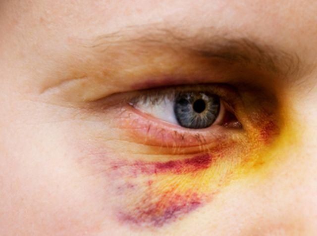 Судмедэксперт побил киевлянина, который пришел снимать побои (Видео) Судмедэксперт побил киевлянина, который пришел снимать побои (Видео)