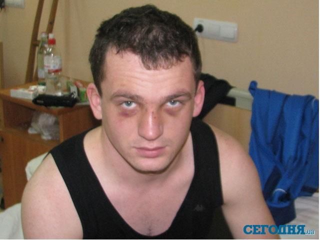 Охранники одного из львовских клубов сильно избили бизнесмена (Фото) Охранники одного из львовских клубов сильно избили бизнесмена (Фото)