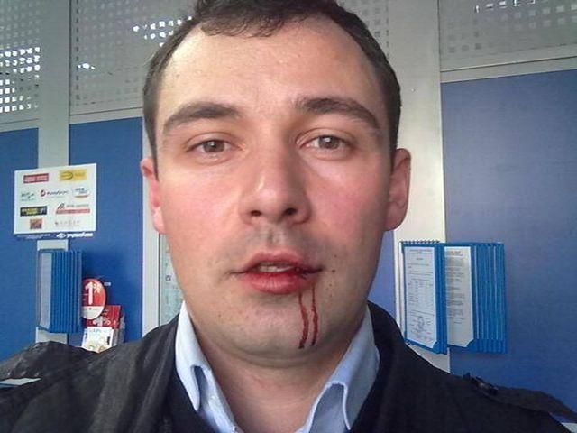 В Житомире избили лидера Демальянса В Житомире избили лидера Демальянса