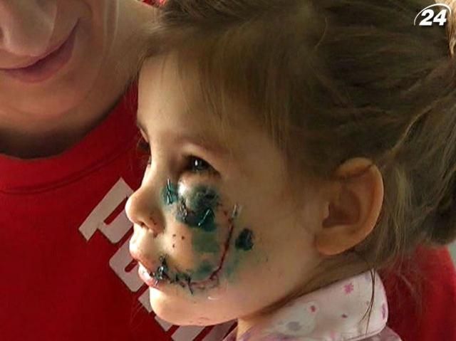 На Луганщине пес едва не разорвал ребенку лицо На Луганщине пес едва не разорвал ребенку лицо