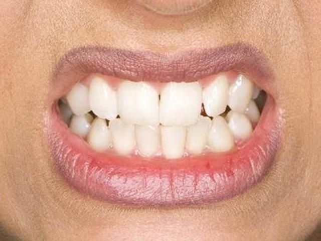 На Закарпатті 50-річна вчителька покусала ученицю 2-го класу На Закарпатті 50-річна вчителька покусала ученицю 2-го класу