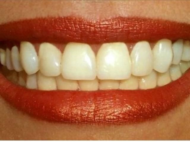 Вчительку, яка покусала дитину, відсторонили від роботи Вчительку, яка покусала дитину, відсторонили від роботи