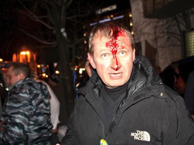 В схватке между беркутовцами и активистами есть раненые (Фото) В схватке между беркутовцами и активистами есть раненые (Фото)