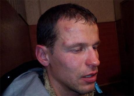 Одеський активіст сам вдарився об корпус машини, - міліція