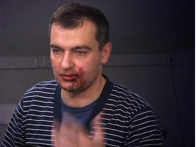 У зв’язку з побиттям журналістів відкрили кримінальне провадження У зв’язку з побиттям журналістів відкрили кримінальне провадження