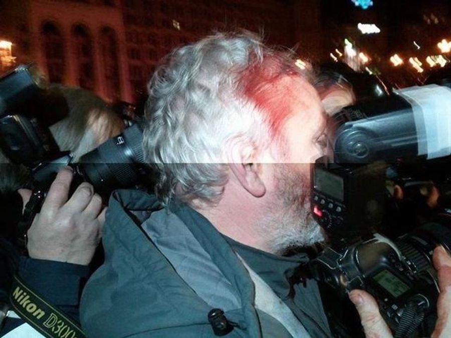 "Беркутівці" кийком розбили голову фотокору Reuters (Фото) "Беркутівці" кийком розбили голову фотокору Reuters (Фото)