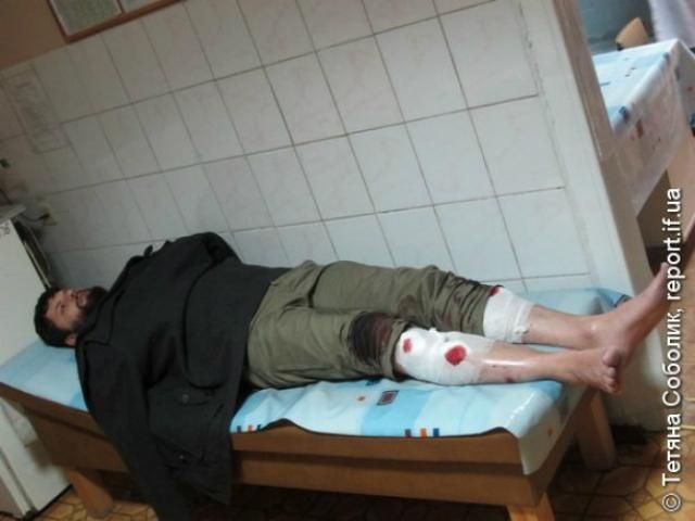 В Ивано-Франковске жестоко избили одного из лидеров Евромайдана (Фото. Видео)