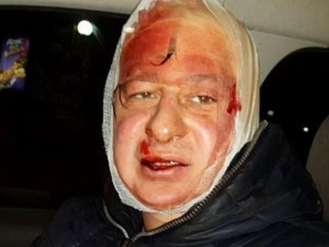 8 "беркутовцев" избили фотожурналиста Лиги (Фото)