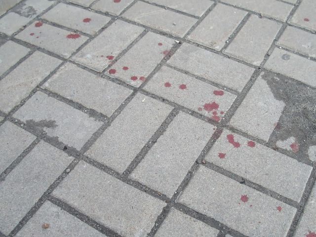 Мужчина возле Евромайдана умер от туберкулеза, - экспертиза Мужчина возле Евромайдана умер от туберкулеза, - экспертиза