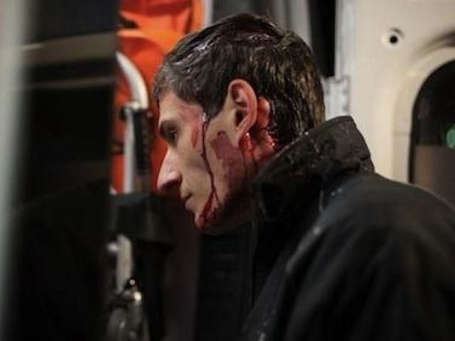 На Майдане создали стену памяти избитых активистов На Майдане создали стену памяти избитых активистов