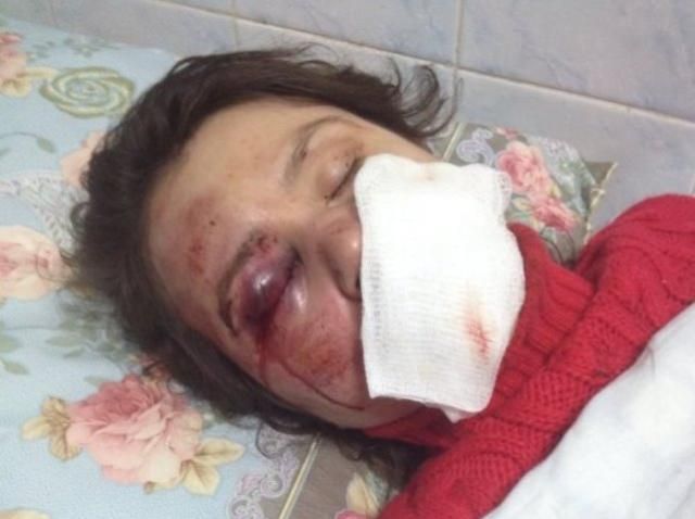 Черновол прокомментировала жестокое нападение на нее Черновол прокомментировала жестокое нападение на нее