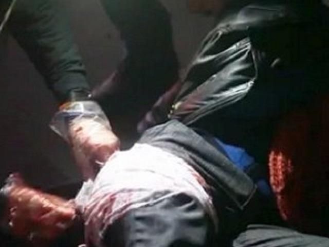 За фактом нападу на харківського євромайданівця відкрили кримінальне провадження За фактом нападу на харківського євромайданівця відкрили кримінальне провадження