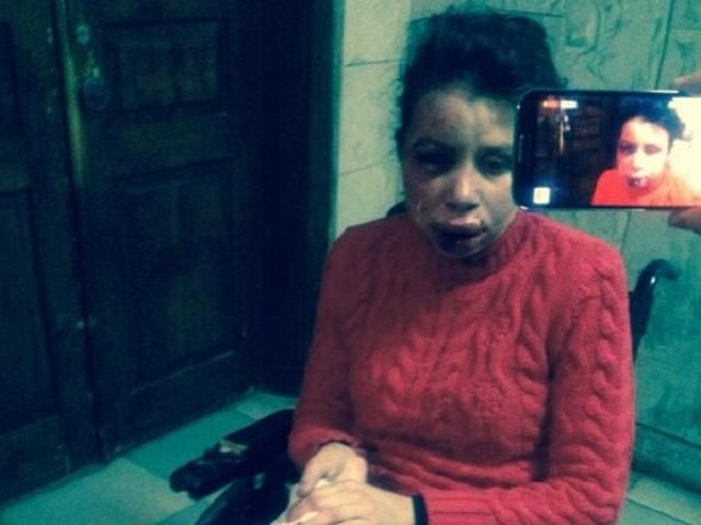 Чорновол — у реанімації. Опозиція каже, що за журналісткою слідкували спецслужби Чорновол — у реанімації. Опозиція каже, що за журналісткою слідкували спецслужби